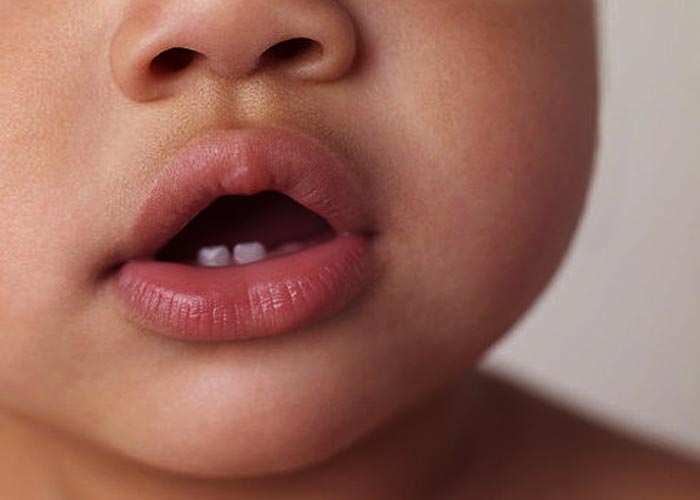 Mon Enfant Fait Ses Dents Sante Senegal Com Conseil Sante Prevention