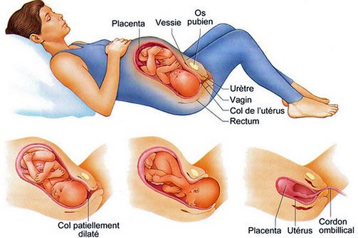 Accouchement-étape-par-étape