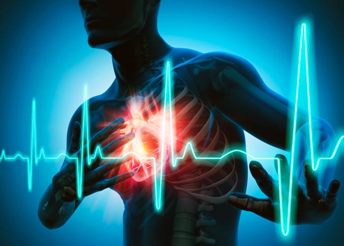 Infarctus du myocarde - Santé Sénégal - Le guide d’Information Santé et