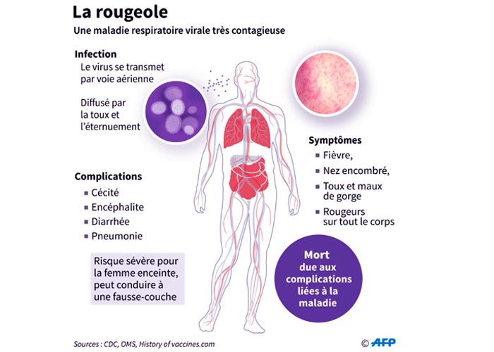 Rougeole-sante-senegal
