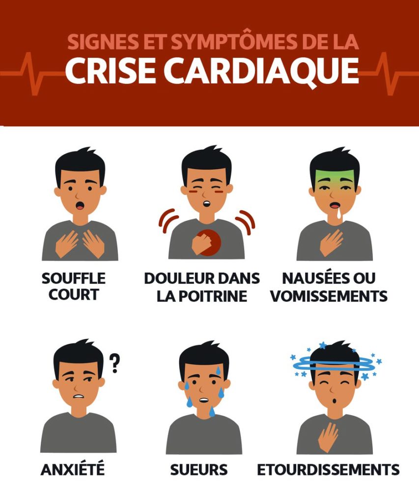 signes-symptomes-infarctus