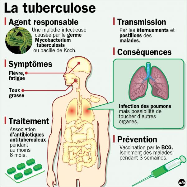 tuberculose