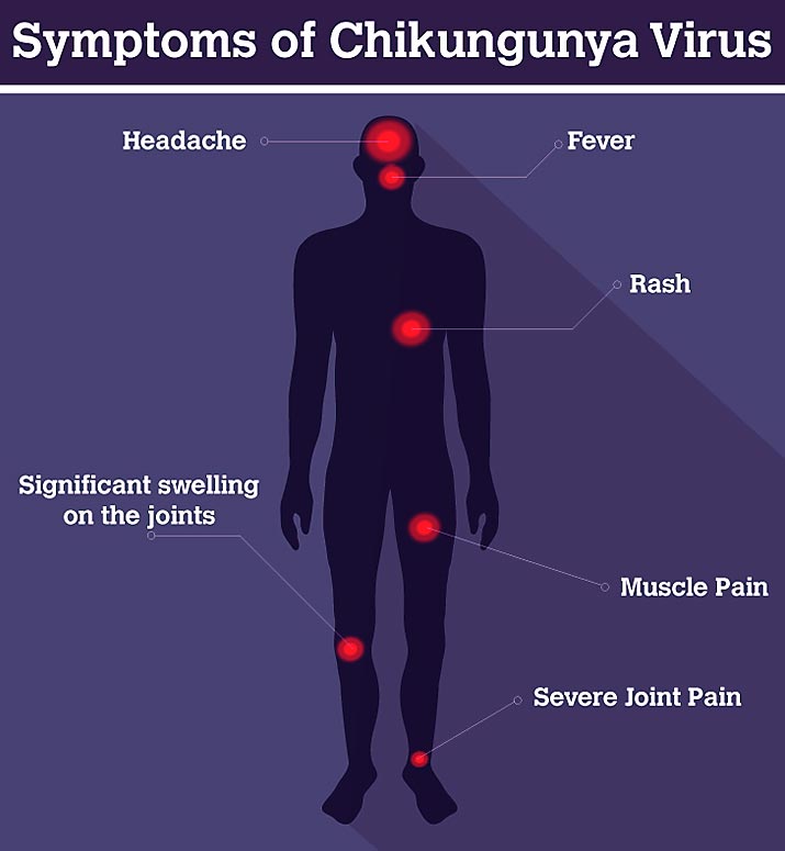 Chikungunya-Symptoms