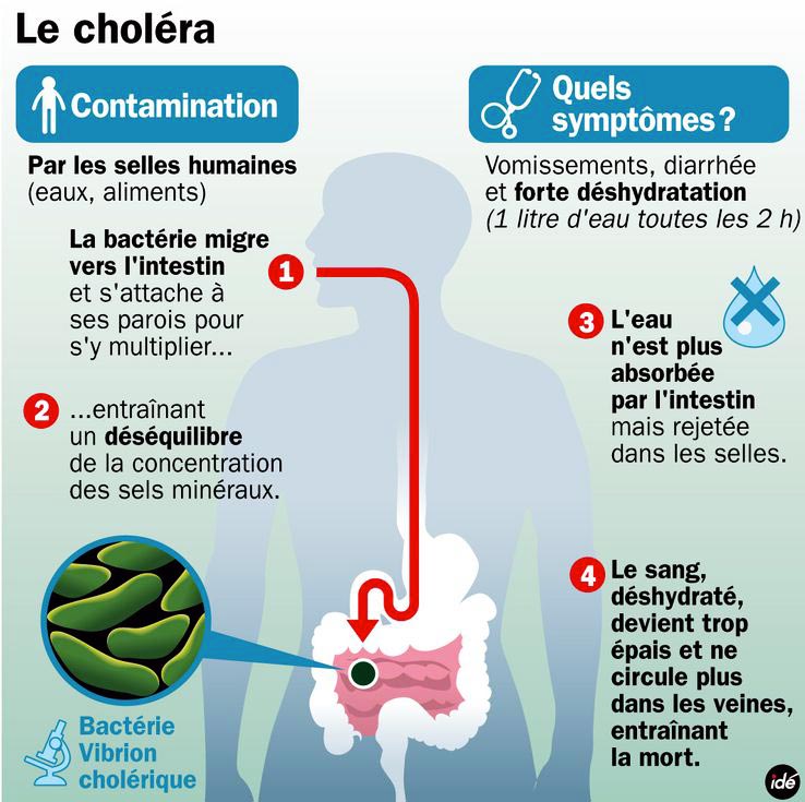 cholera-symptomes