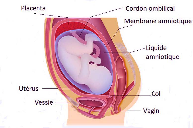 Différents types de l'insertion des membranes amniotiques sur le pourtour  du placenta