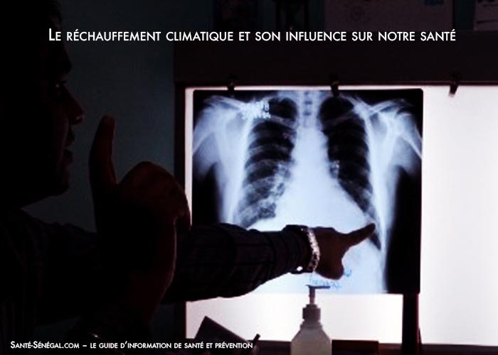 Le-réchauffement-climatique-et-son-influence-sur-notre-santé