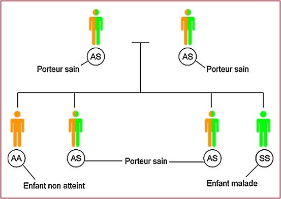 Drépanocytose-sante-senegal