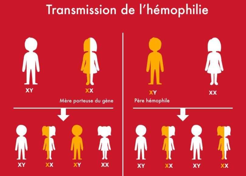 Malgré sa gravité, l’hémophilie reste encore mal des senegalais