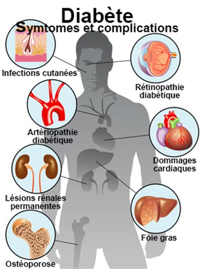 Diabète-sante-senegal