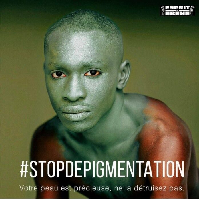 depigmentation-stop