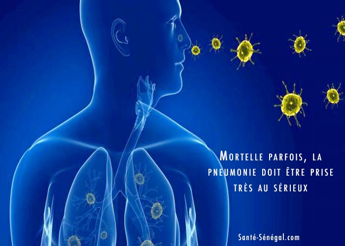 Mortelle-parfois-la-pneumonie-doit-être-prise-très-au-sérieux