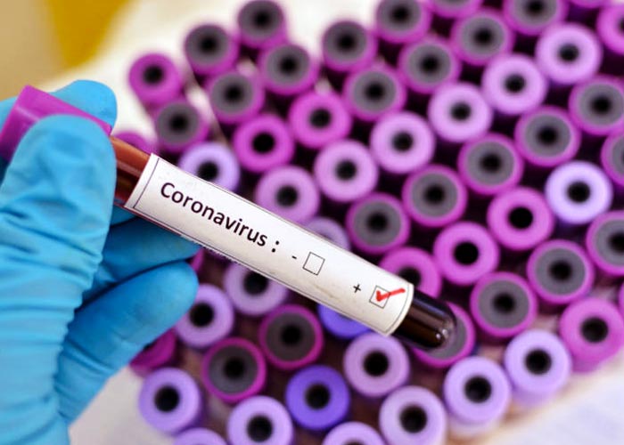 Que-savons-nous-des-coronavirus-(CoV)-