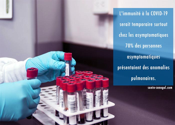 L'immunité-a-la-COVID-19-serait-temporaire-surtout-chez-les-asymptomatiques