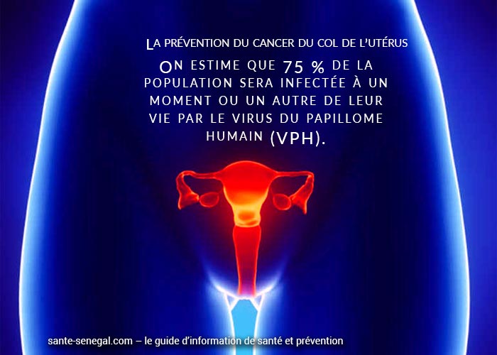 Cancer-du-col-de-l’utérus-Mesures-préventives-de-base