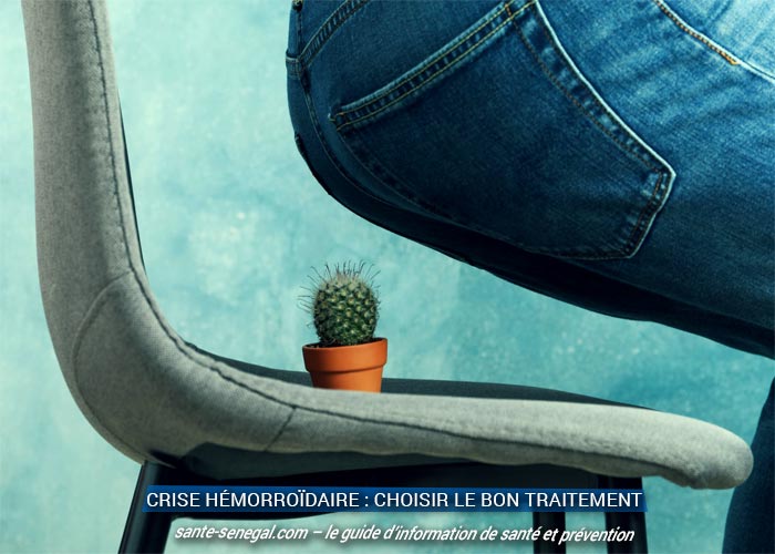 Crise hémorroïdaire : choisir le bon traitement