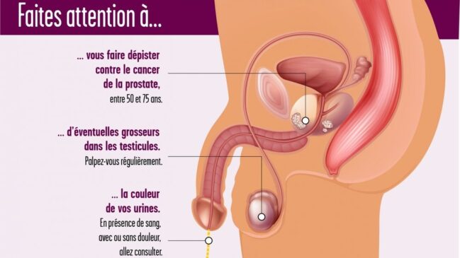 cancers-urologique